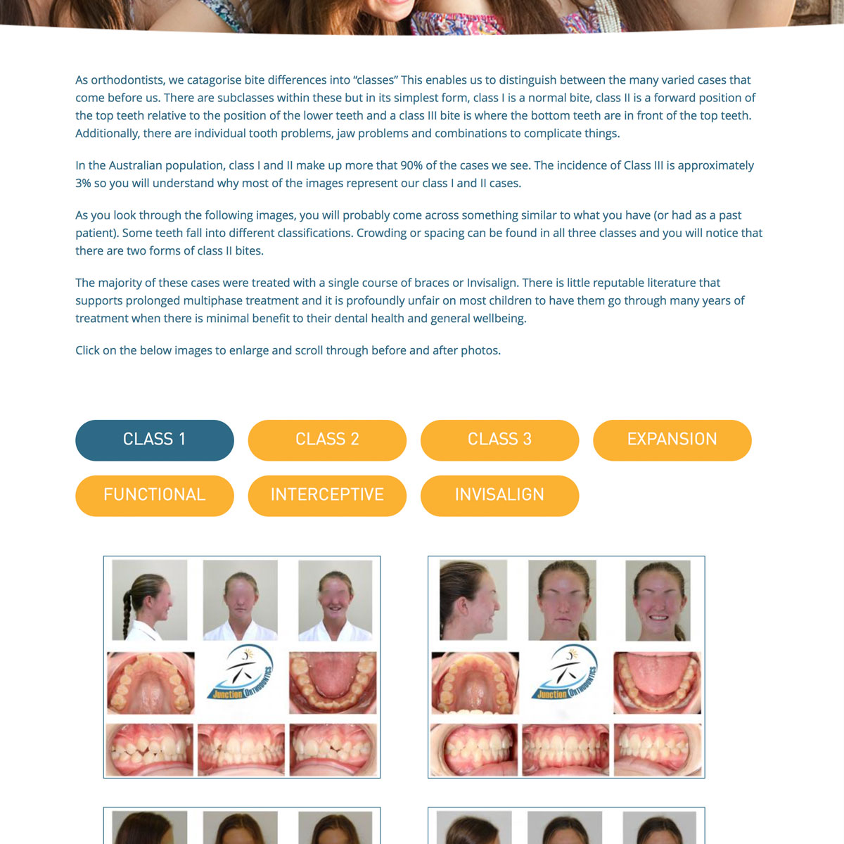 Junction Orthodontics - Smiles Gallery